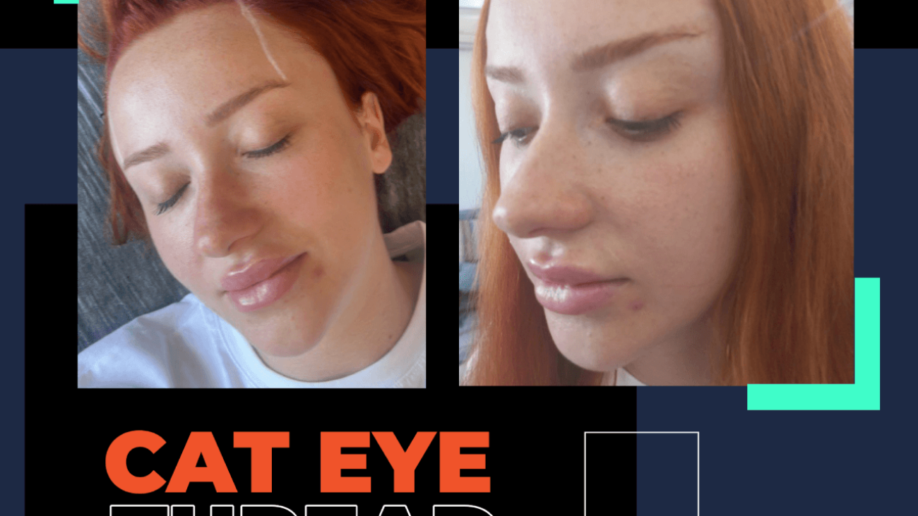 bodrum cat eye thread lift, kaş kaldırma