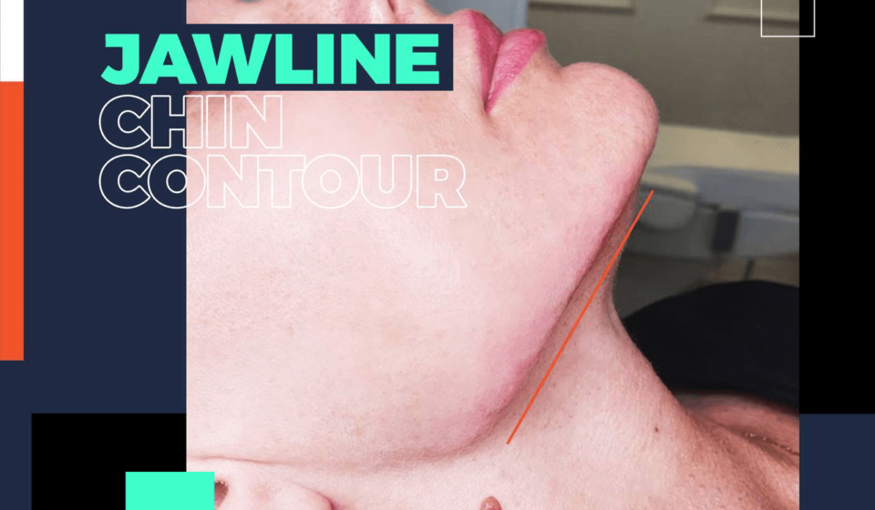 bodrum jawline chin contour