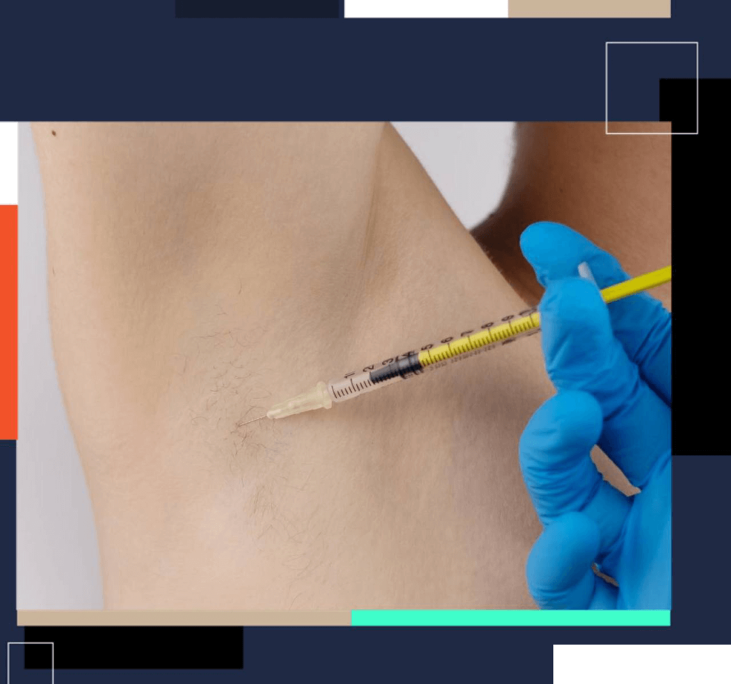 botox sweating underarm armpits, terleme botoksu