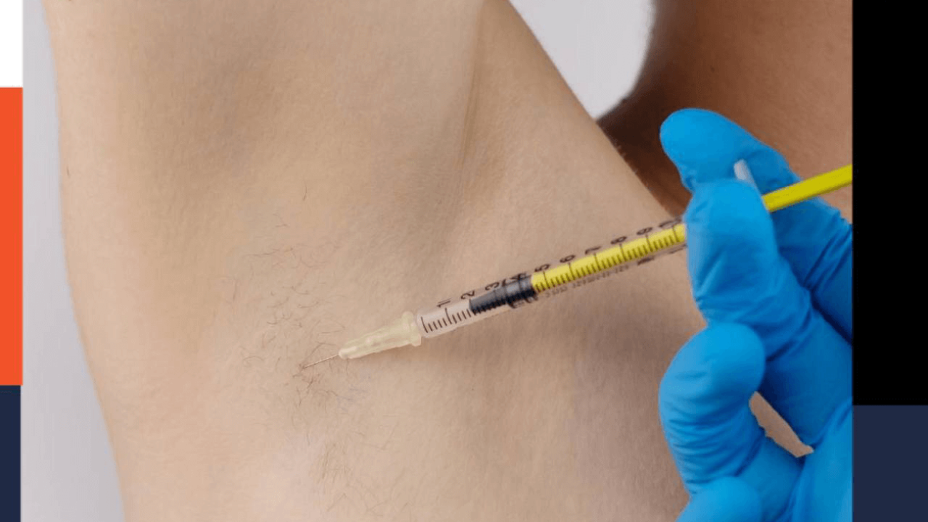 botox sweating underarm armpits, terleme botoksu