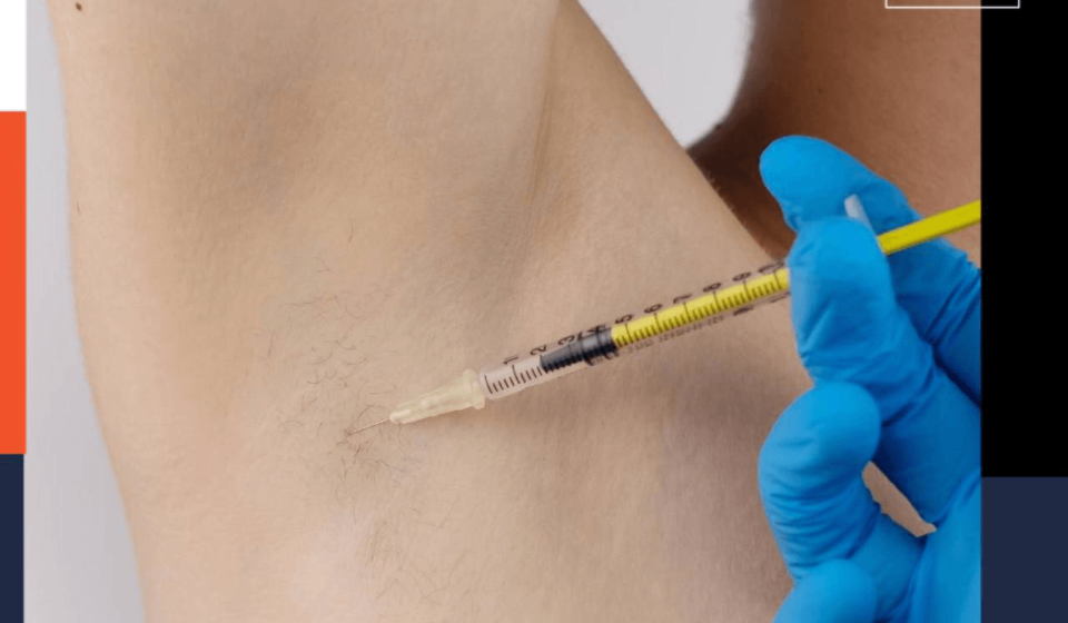 botox sweating underarm armpits, terleme botoksu