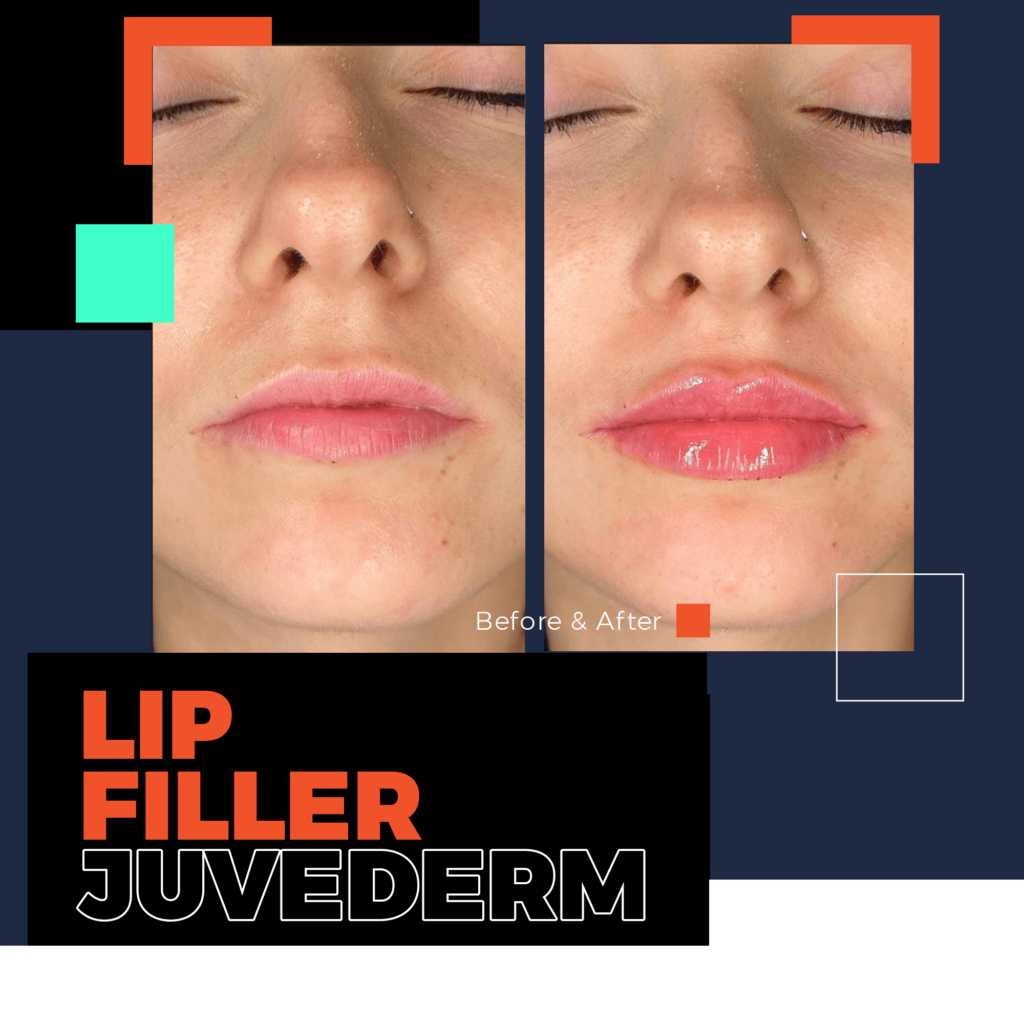 medical aesthetics doctors bodrum